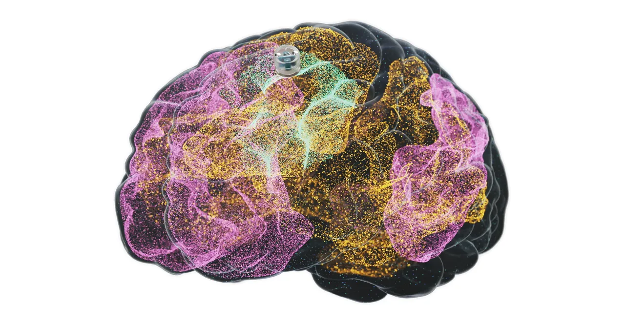 A brain transplant to treat depression is about to be tested on humans